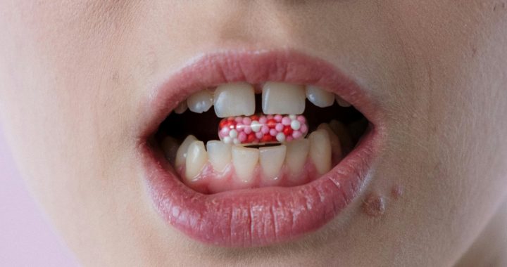 Warning Signs of a Tooth Infection: Symptoms That Need Urgent Dental Attention